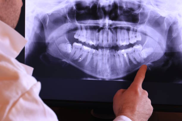 Best Pediatric Emergency Dentist in Henry, IL