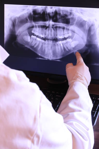 Best Emergency Broken Tooth Repair in Henry, IL