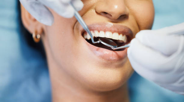 Best Emergency Wisdom Teeth Removal in Henry, IL