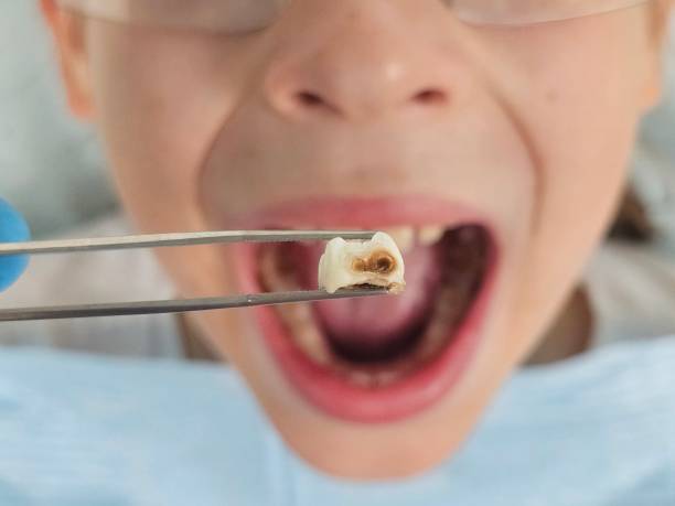 Best Emergency Broken Tooth Repair in Henry, IL